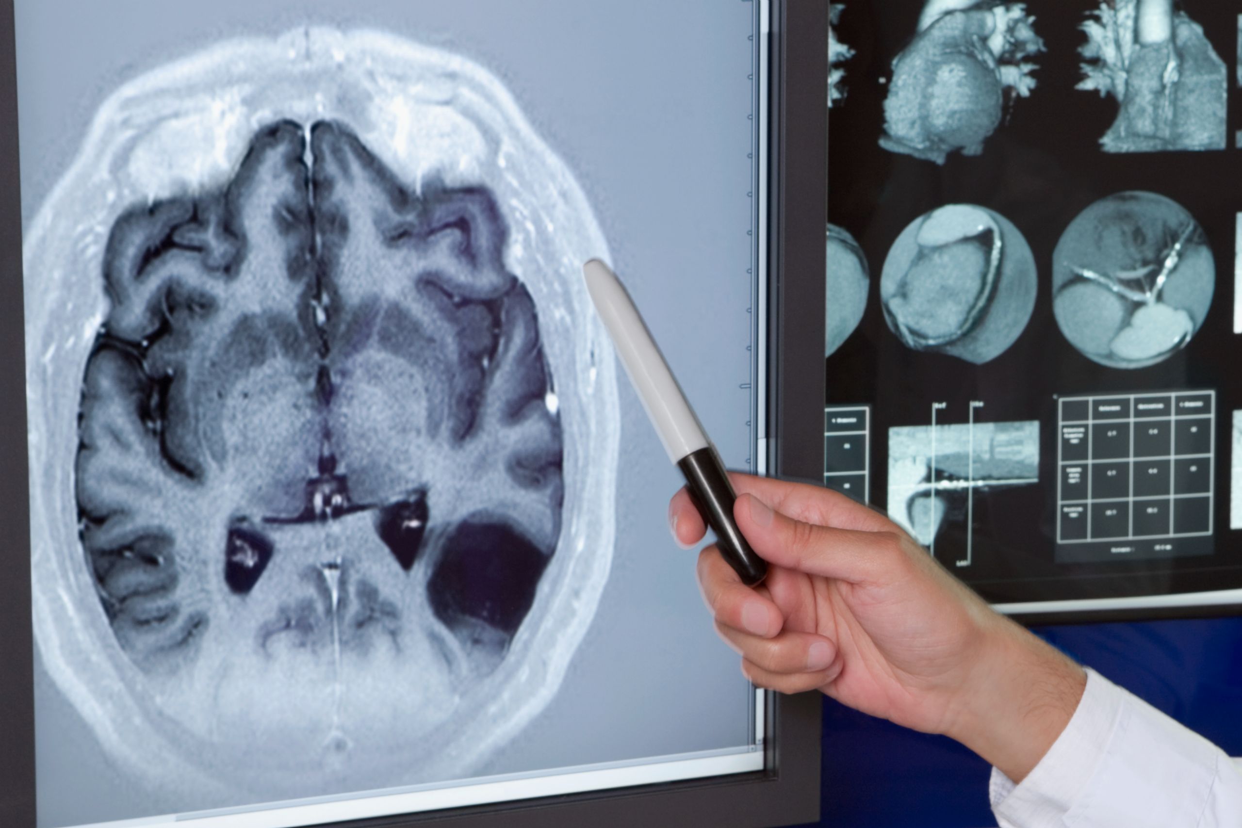MRI 처음부터 끝까지 알려드립니다 사진